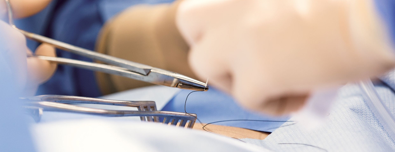 Chirurgie ambulatoire, ce qu&rsquo;il faut savoir